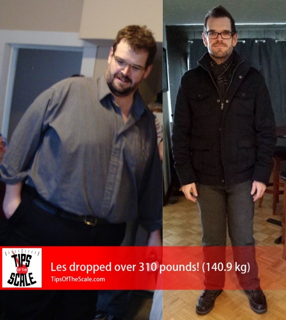 Les Stratford Before & After