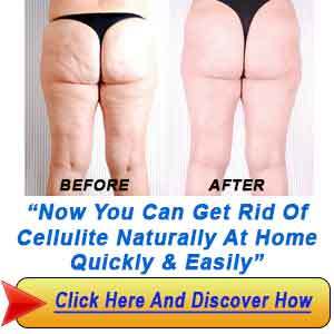 How-To-Get-Rid-Of-Cellulite-Naturally