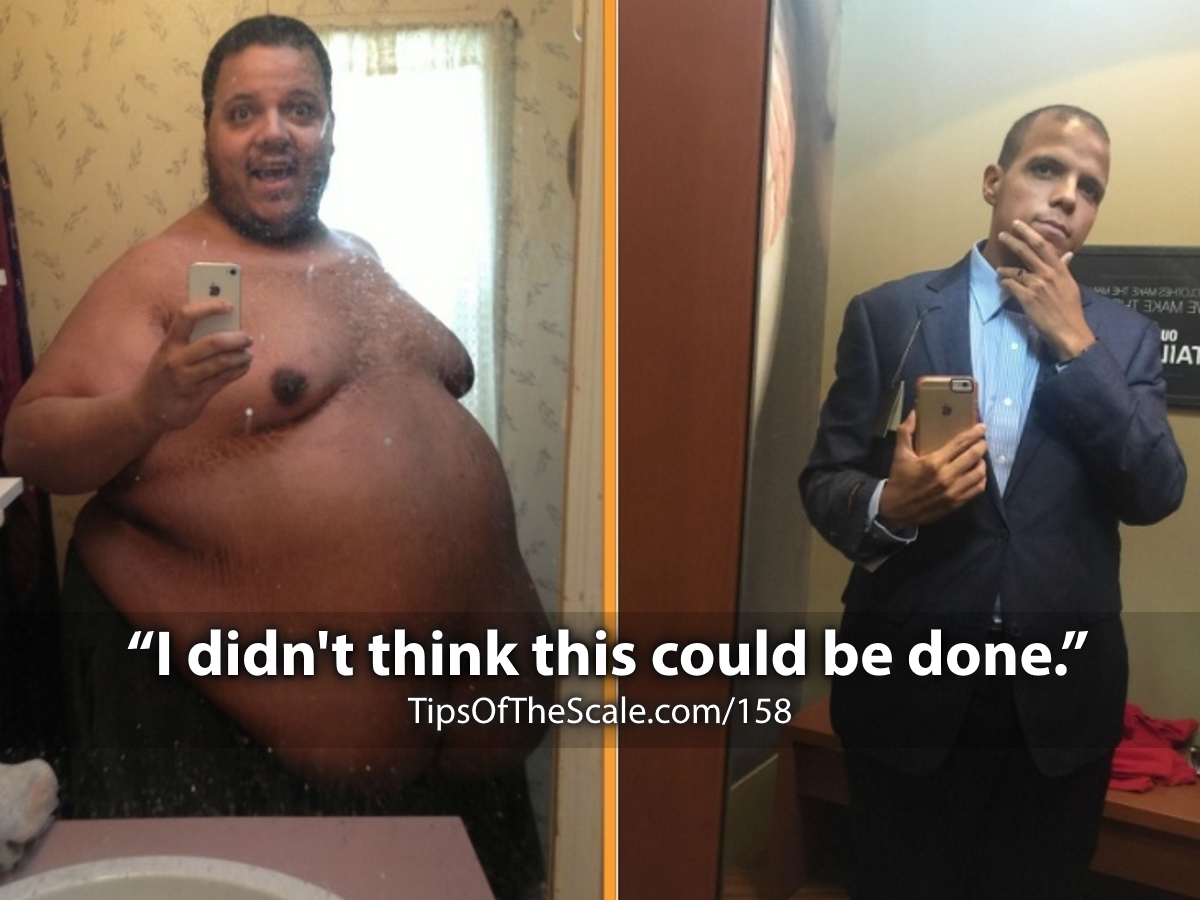 Jesse Shand Before-After