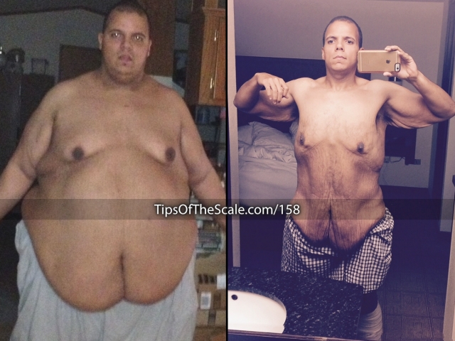 Jesse Shand Before and After (Then and Now)